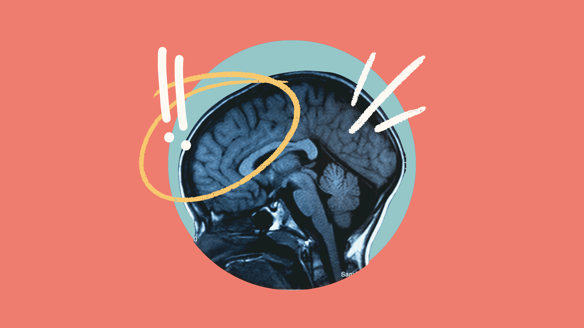 Do MRI scans actually improve your health?