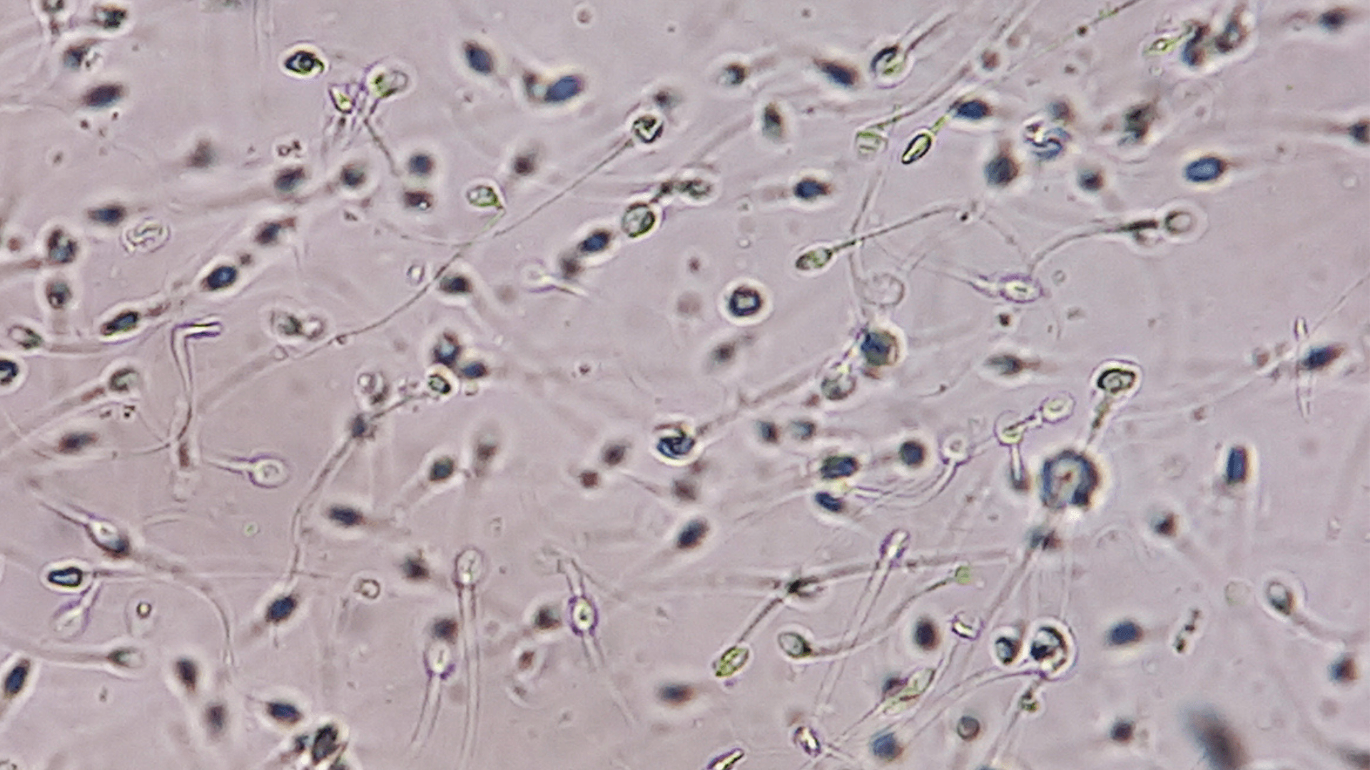 What is a normal sperm count?