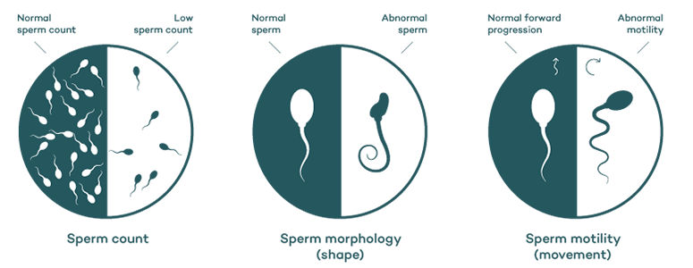 Sperm health_Diagram